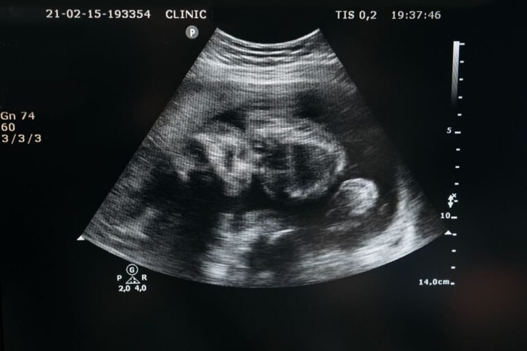 5 Ways Ultrasound Imaging is Revolutionizing Brain Health Monitoring